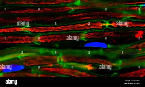 Nerve Axon Micrograph Hi Res Stock Photography And Images Alamy