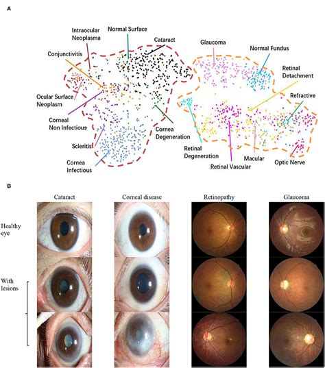 Frontiers A Novel Hierarchical Deep Learning Framework For Diagnosing