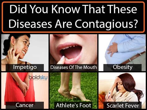 Did You Know That These Diseases Are Contagious? - Boldsky.com