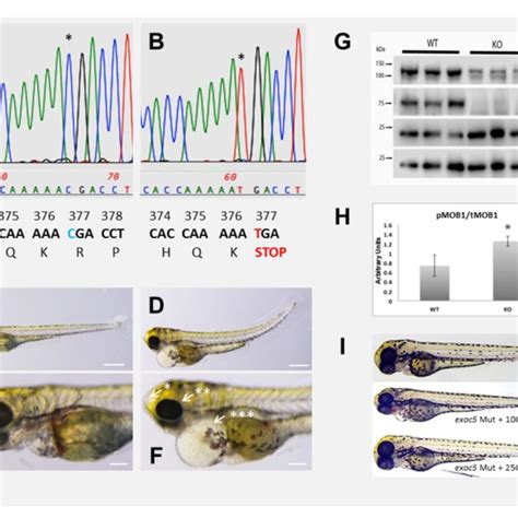 Exoc Mutant Zebrafish Show Ciliopathy Phenotypes And Upregulation Of