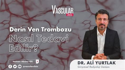 Derin Ven Trombozu DVT Nasıl Tedavi Edilir DVT Riskleri Nelerdir