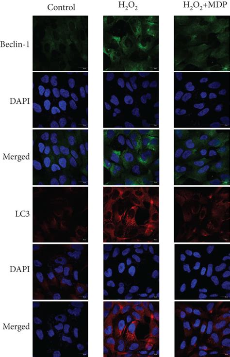 Autophagy Related Protein Expression In An Htr Svneo Cell Oxidative