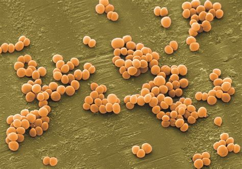 Enfermedades Nosocomiales Staphylococcus Aureus