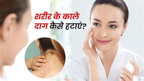 शरीर से काले दाग हटाने के लिए अपनाएं ये 5 घरेलू उपाय How To Remove