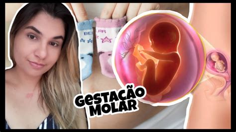 Tudo Sobre A Minha Gesta O Molar Youtube