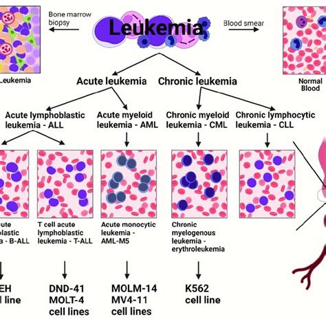 The Different Types Of Human Leukemia Cell Lines Created With Download Scientific Diagram