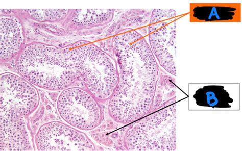 Male Repro Histology Flashcards Quizlet