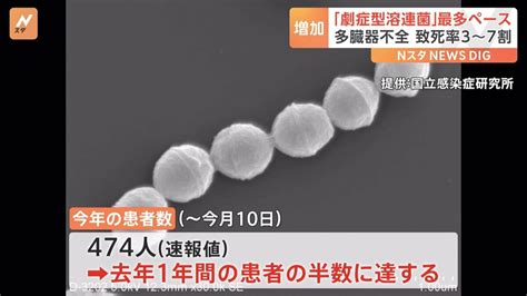 「劇症型溶連菌」すでに去年1年間の患者数の5割超える 過去最多の去年上回るペースで増加 約2か月で474人 致死率“3割～7割” Tbs