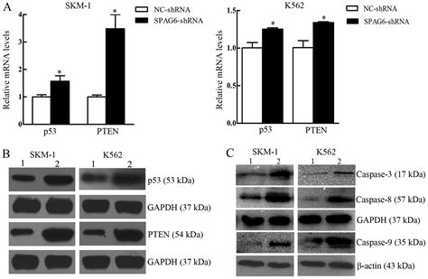 Spag6 Silencing Inhibits The Growth Of The Malignant Myeloid Cell Lines