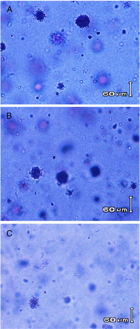 Anti Tumor Promoting Effects Of The Curcumin Encapsulated By Copolymer