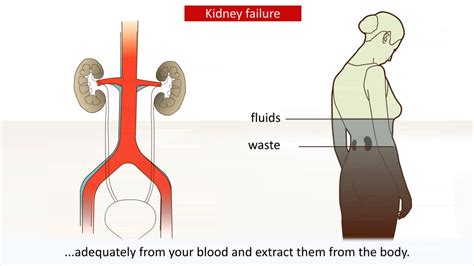 Kidney Failure Causes