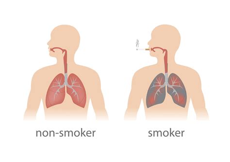 Cigarettes Before And After Lungs