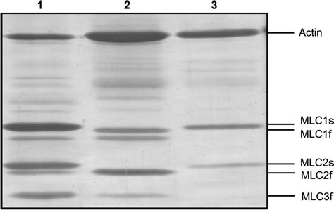 Myosin Light Chain Mlc Isoform Analysis By Sds Page Of Muscle Samples