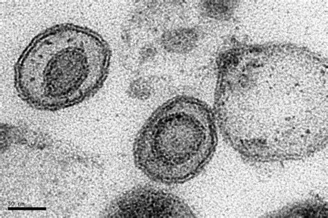 Transmission Electron Micrograph Of Herpes Like Virus Enveloped