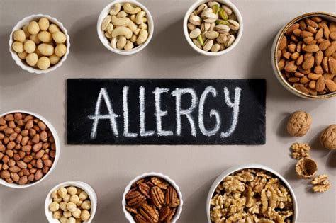 The 10 Most Common Food Allergies Green Health Foundation