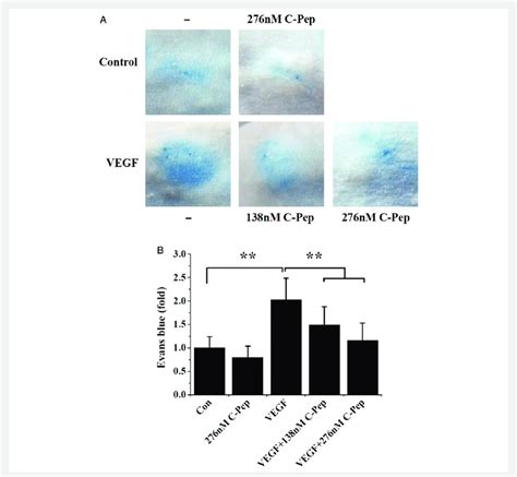 C Peptide Prevents Vegf Induced Vascular Leakage In The Peripheral