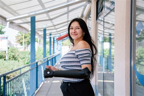 Worlds First 3D Printed Bionic Arm Is Now Available To Amputees Across