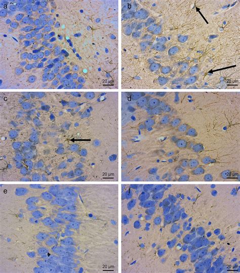 Photomicrographs of histological sections of the CA3 region of ... 