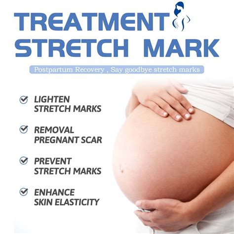 Removal Scar Stretch Marks Firming Stretch Marks Fading For Scar Striae