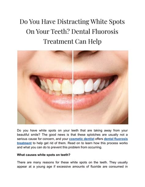 Ppt Do You Have Distracting White Spots On Your Teeth 1 Powerpoint Presentation Id 11491664