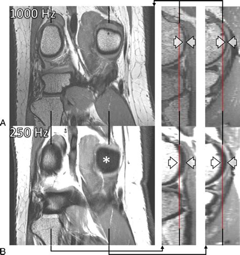 T Musculoskeletal Mri Fundamentals And Clinical Implementation Pmc