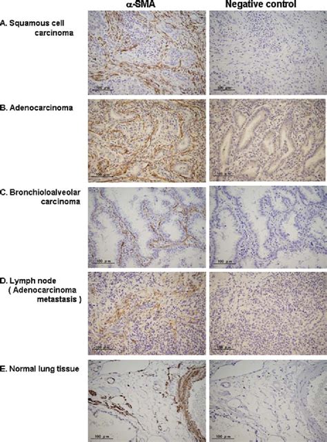 Figure From Imatinib Mesylate Inhibits The Proliferation Stimulating