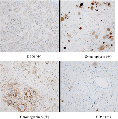 Immunohistochemistry Staining S Synaptophysin