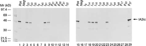 Ia2 Antibody Analysis In 38 Kd Gad65 Antibody Negative Individuals And Download Scientific