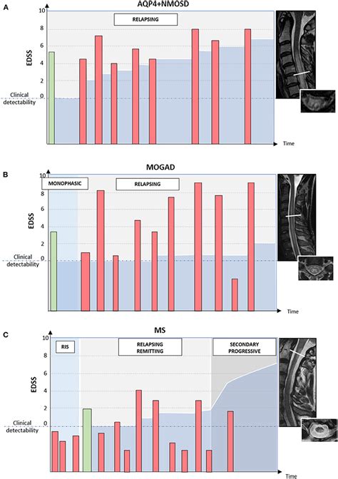 Frontiers Myelitis Features And Outcomes In Cns Demyelinating Disorders Comparison Between