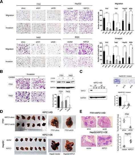 Kifc1 Promotes Hcc Cell Invasion In Vitro And Accelerates Intrahepatic