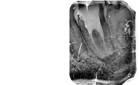 Post Operative Radiograph Download Scientific Diagram