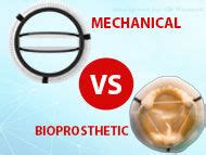 Mechanical Vs Bioprosthetic Heart Valve Replacements