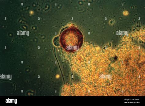 Shelled Protozoan Amoeba Light Micrograph Of A Shelled Amoeba