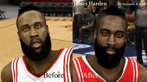 James Harden Teeth Fixed