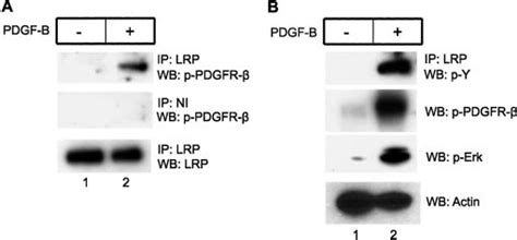 Phospho Pdgfr And Lrp Co Immunoprecipitate In Cells Treated With Pdgf