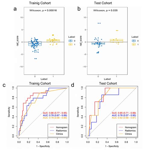 Class 0and Class 1 Rad Score Comparison ROC Curves And The AUC Of