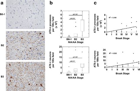 The Nucleus Accumbens Demonstrates P Mapt Neuropathology In Nia Aa