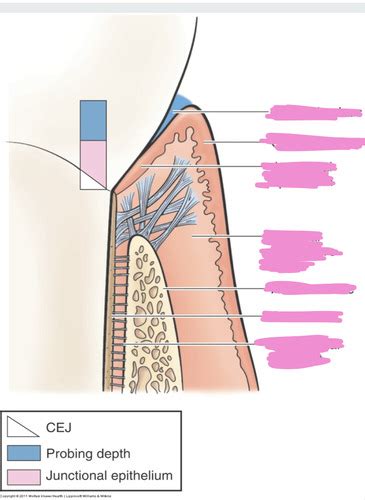 Lecture 4 Exam 3 Gingival Diseases Flashcards Quizlet