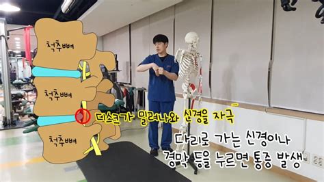 갑자기 허리가 아플 때 내 통증의 원인은 무엇일까 허리디스크 척추협착증 척추분리증 만성요통 네이버 블로그