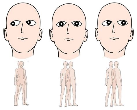 Diagnosis Diplopia Alomedika