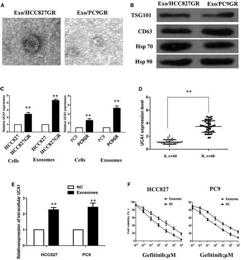 Characterization Of Exosomes Derived From Hcc Gr And Pc Gr Cells A