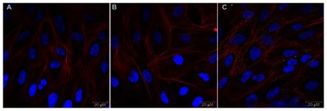 Clsm Of Hcmec D3 Cells After Incubation With Lip Hcmec D3 Cells Were Download Scientific