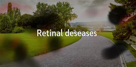 Retinal diseases - Sistina Ophthalmology