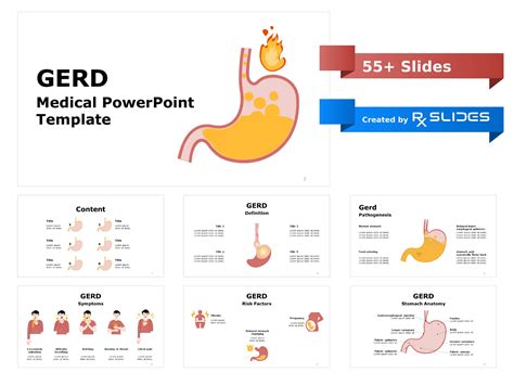 Download Gastroesophageal Reflux Disease Gerd Powerpoint Template