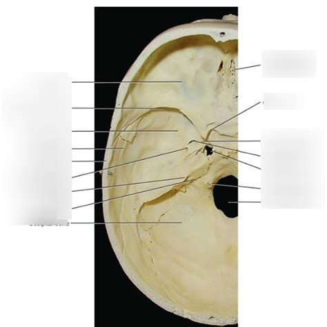 Internal Skull Superior View Diagram Quizlet