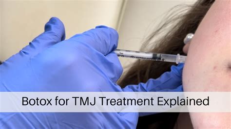 Botox for TMJ Treatment Explained — Wellness Revolution