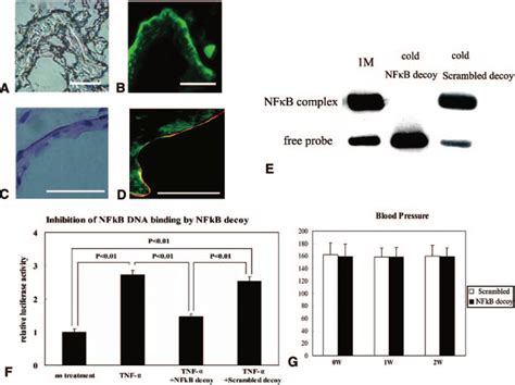 Effect Of NF B Decoy ODN On The Initiation And Progression Of CAs A