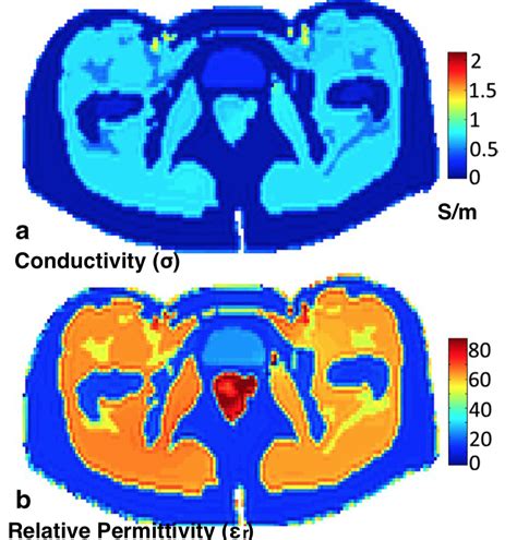 Magnetism Questions And Answers In Mri