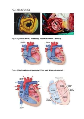 Sist Cardiovascular Glosario PDF