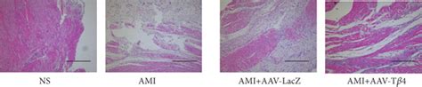 AAV Tβ4 alleviates ligation induced heart fibrosis in mice Detection